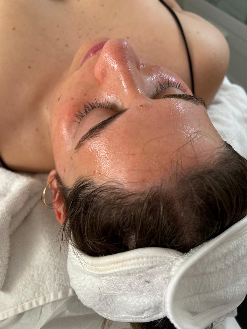 Glowing skin results after facial treatment