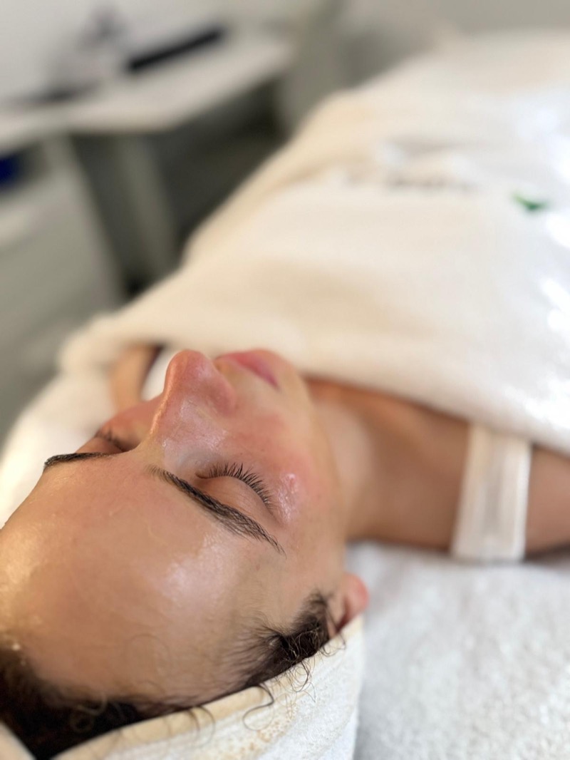 Radiant hydrated skin after professional treatment