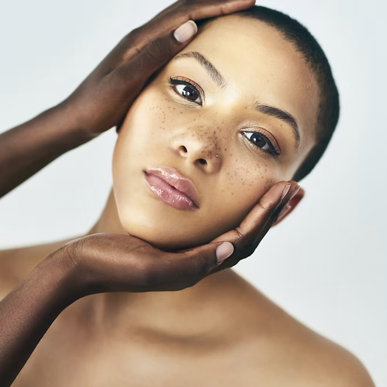 טיפול בפיגמנטציה בקריות - העלמת כתמי שמש וגיל